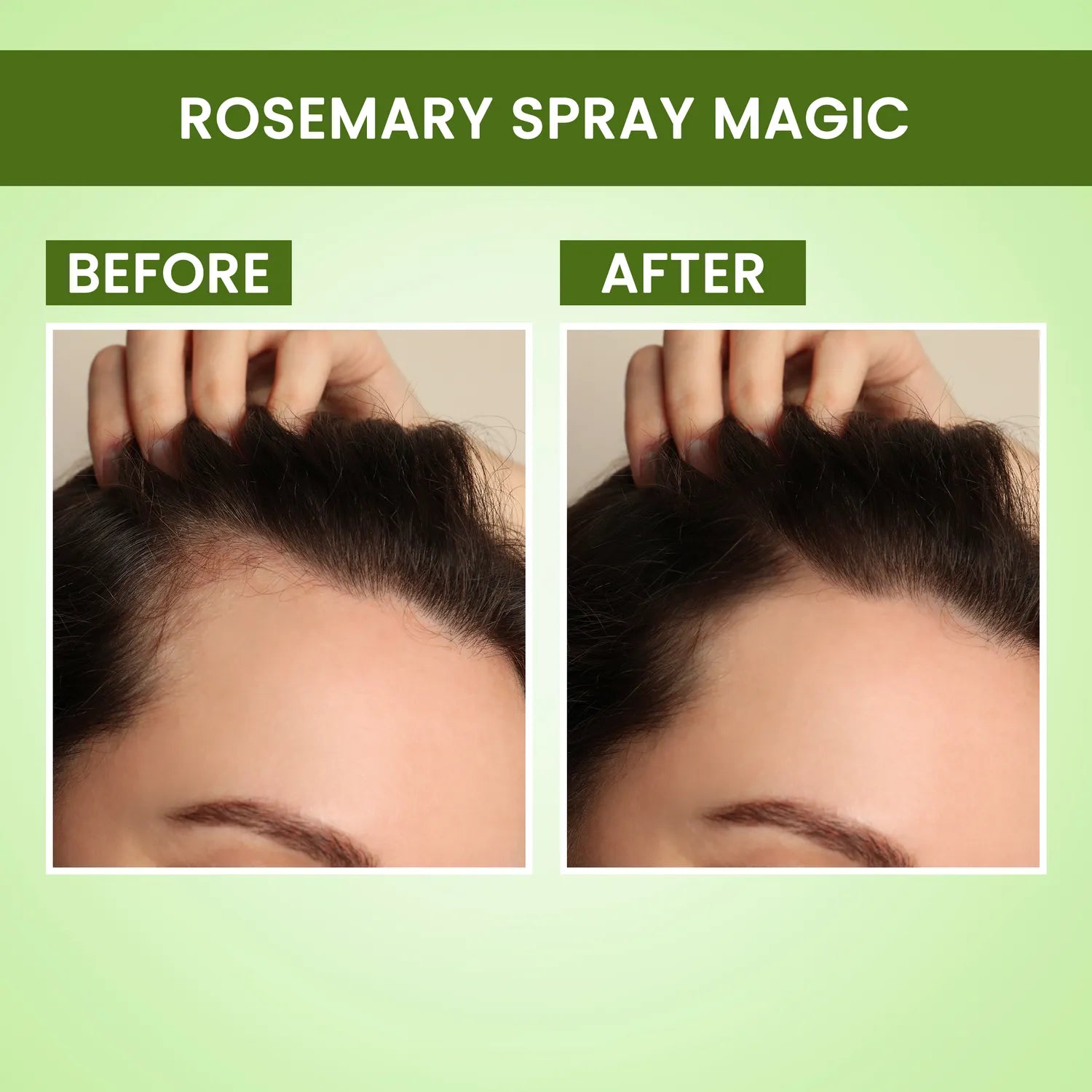 Hair Growth Essentials Duo with Rosemary Water Spray (200 ml) & Rosemary Water Refill Pack (305 ml)| Hair Growth Expert | Thick-Long Hair | Scalp Health